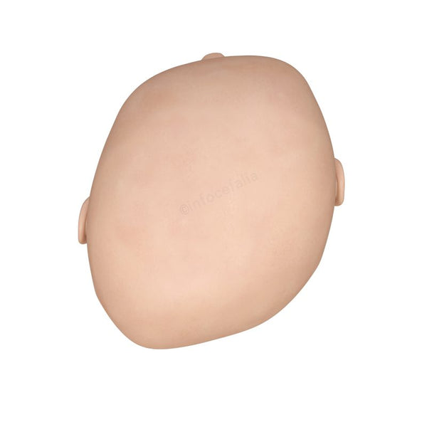 Plagiocephaly